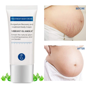 TOMUM Stretch marks cream for pregnancy