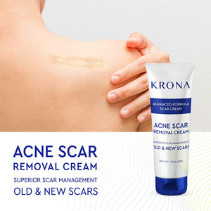 Krona  Scar Removal Cream For Old Scars -Stretch Mark Removal Cream for Men and Women