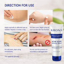 Load image into Gallery viewer, Krona  Scar Removal Cream For Old Scars -Stretch Mark Removal Cream for Men and Women